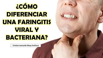 ¿Cómo saber si la faringitis estreptocócica es bacteriana o vírica?