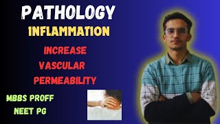 Inflammation Unit 2 Increased Vascular Permeability Lecture 4 NEET PG MBBS Lecture