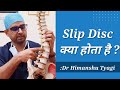 Slip Disc क्या होता है ? (Disc herniation/Disc prolapse/Lumbar PIVD/sciatica/ What is slip disc)