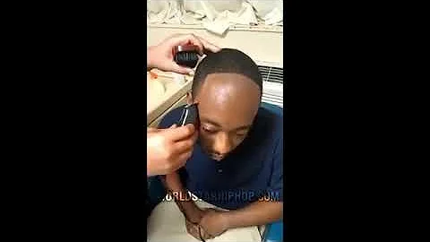 Hairline Chronicles