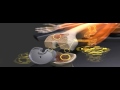 DPY TruMatch Patient Education Animation, credit to “DePuy Synthes Companies”.