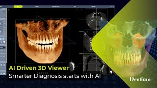 AI Driven 3D Viewer - Smarter Diagnosis starts with AI - 01