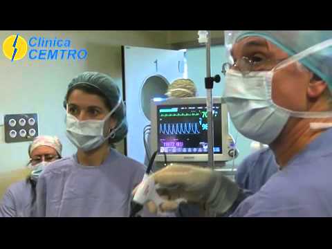 operatie laparoscopica de prostata)