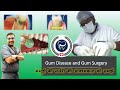 Dr Rudra Mohan |मसूड़ों की सर्जरी की आवश्यकता को समझें| (Pyorrhoea)पायरिया का उपचार