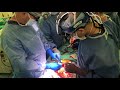 Stanford Cardiothoracic Surgery Residency