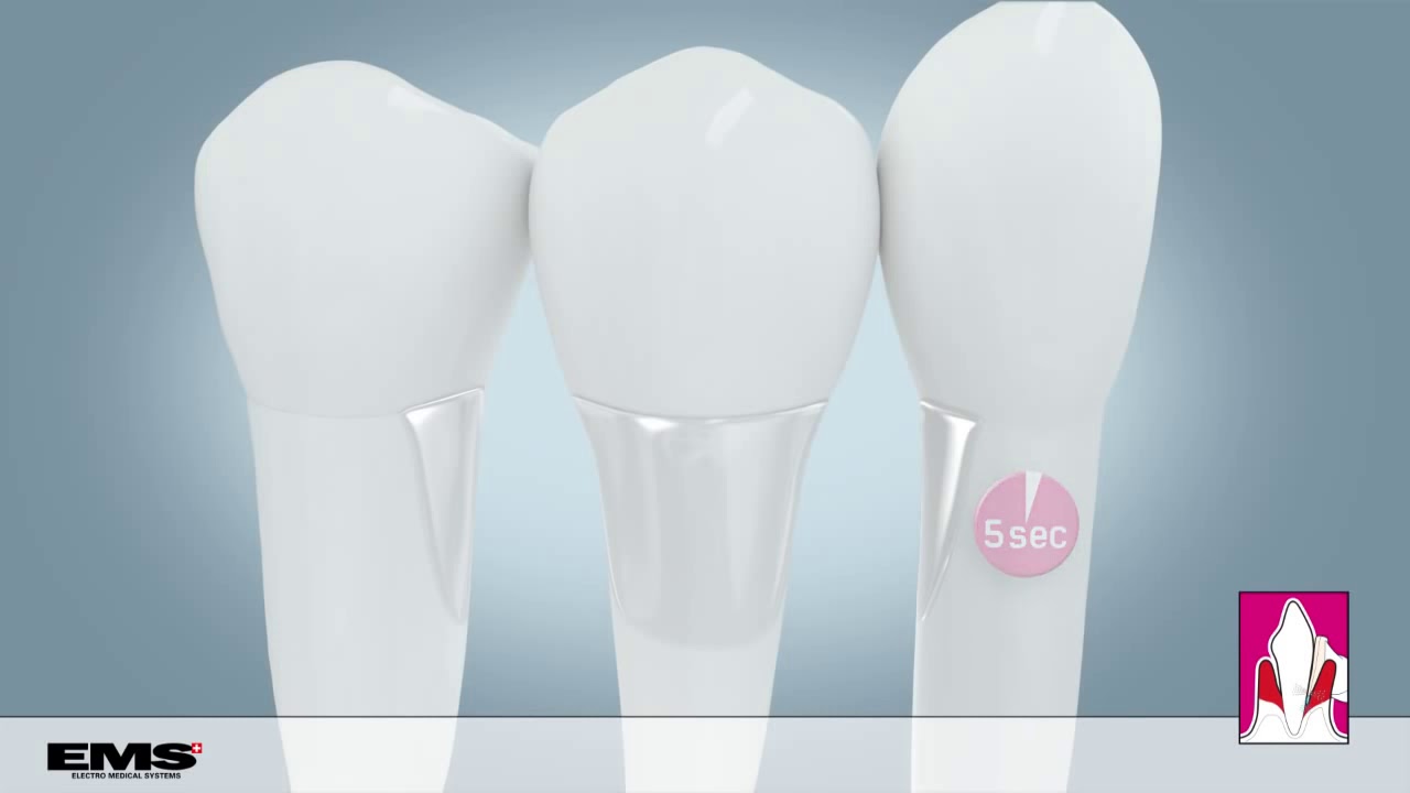 Die Original Therapie AIR FLOW PERIO von EMS deutsche Version YouTube