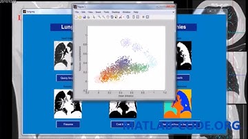 LUNG SEGMENTATION OF FISSURES