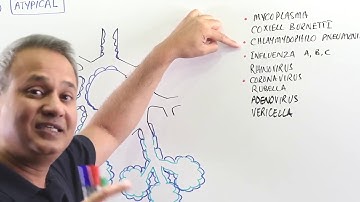 Clinical Manifestations of SARS - Coronavirus (SARS-COV)