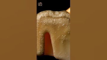 colthes Safety pin melting ASMR Close Up #shorts  #satisfying #closeup #macro #asmr