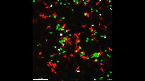 Immune cells fighting infection