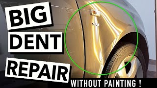 MASSIVE DENT ON A CAR | Paintless Dent Removal Uk 🇬🇧 | Front Fender Smash | By Dent-Remover