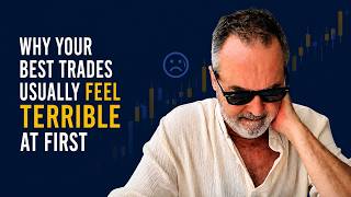 The Hidden Skill That Separates Rich Traders From Broke Traders