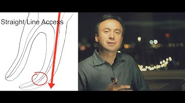 How to Bypass A Broken File: Friday Questions