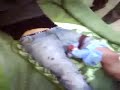 Iranian protestor injured, shot in leg