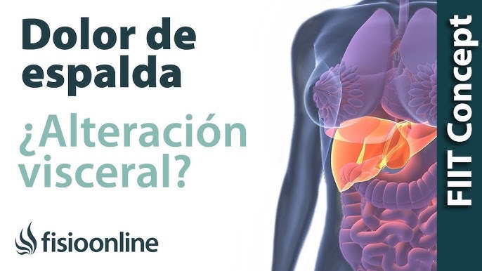 Alivio de la lumbalgia, hernia discal, ciática y escoliosis, faja Ormromra  CPB-DE-SSW333-8