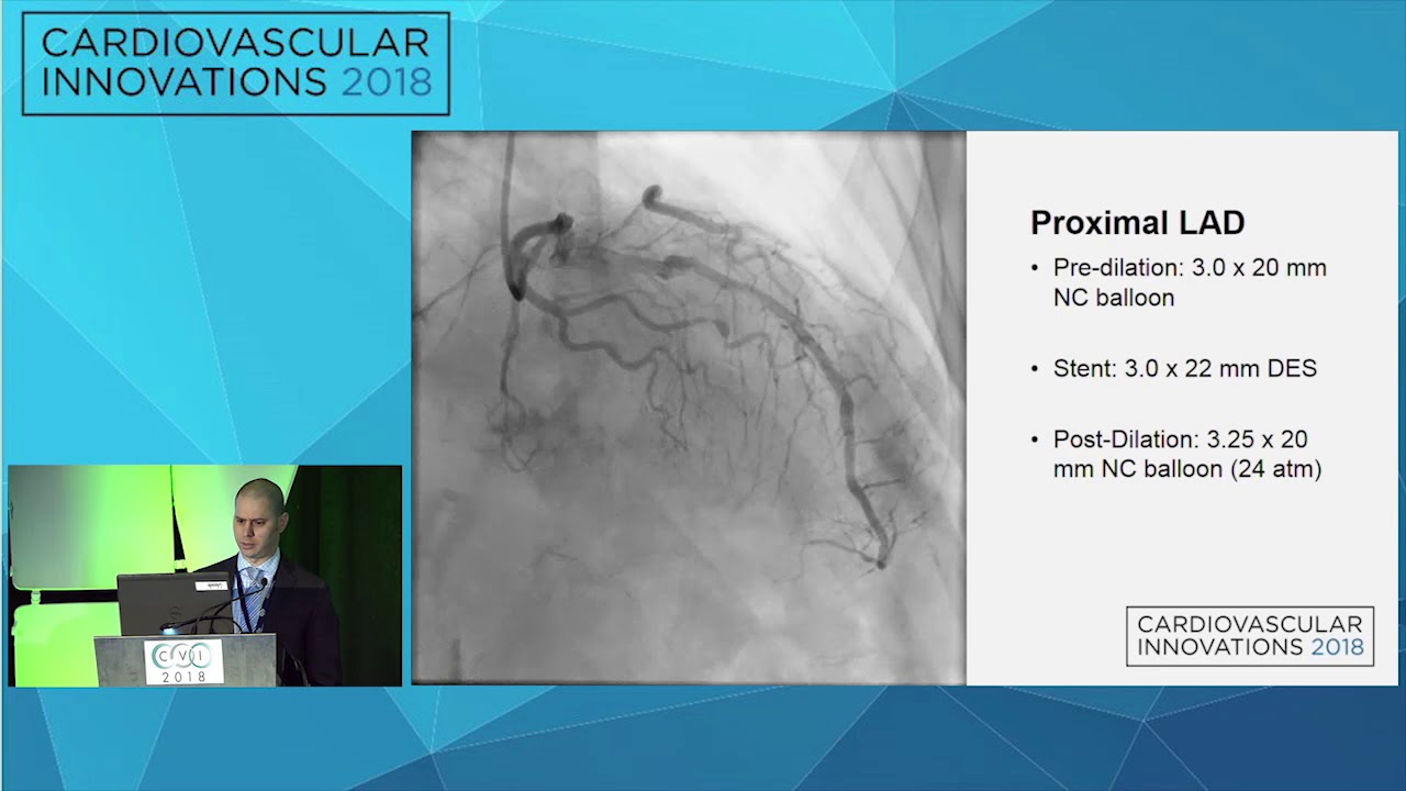 CVI2018 Session: Complex Multivessel PCI Prior to TAVR using a Transradial Approach interventional cardiology jobs
