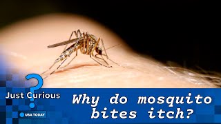 Why Do Mosquito Bites Itch? Here Are The Dangers Of Scratching | Just Curious