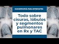 Localización de cisuras, lóbulos y segmentos pulmonares en radiografía y TAC