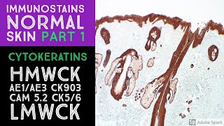 Immunohistochemistry in Normal Skin: Cytokeratins