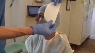 First Stage-p1 of MewVector Orthodontic Orthotropics Headgear (Head Brace) Preparation- Dr Mike Mew