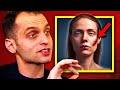 Explained: The Facial Scar Test (Social Experiment)