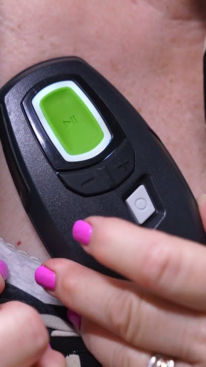 Treating Sleep Apnea With Inspire