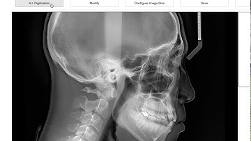WebCeph: A.I.(artificial intelligence) cephalometric analysis platform for dentist