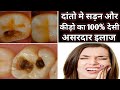 5       home remedy for toothachedant k dard ilajtooth pain remdy