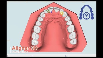 OnyxCeph³™ Overview