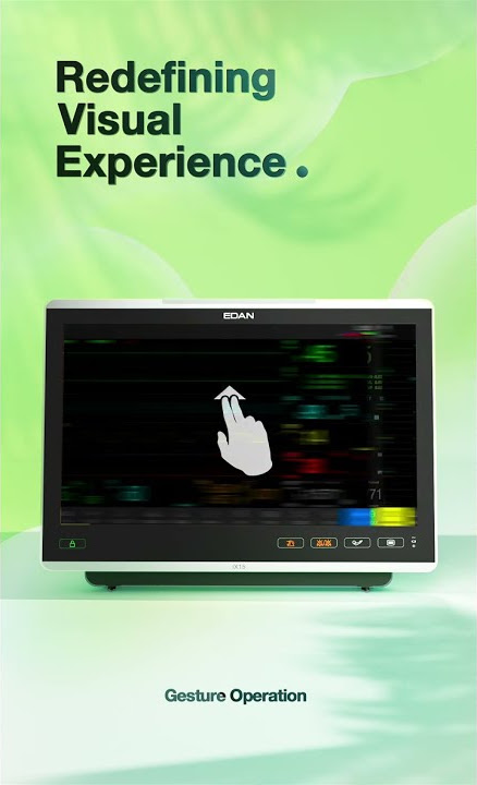 【Preview 1】EDAN iX Series Patient Monitoring Launch