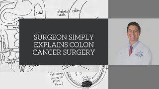 Surgeon Simply Explains Colon Cancer Surgery