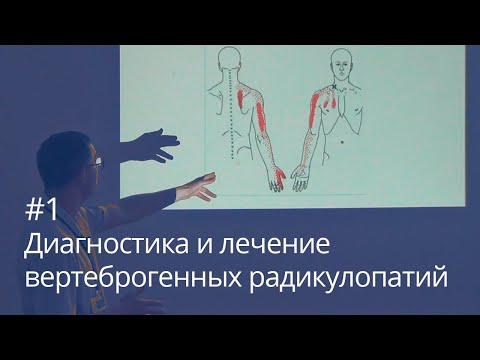 Диагностика и лечение вертеброгенных радикулопатий (часть 1)