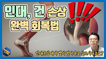 인대와 건(힘줄)이 잘 안낫는 이유! - 페인랩이 말하는 통증이야기