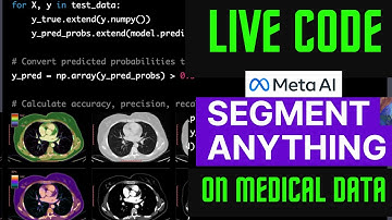 RUNNING SEGMENT ANYTHING MODEL FROM META  ON MEDICAL IMAGING DATA | LIVE CODING DEEP LEARNING