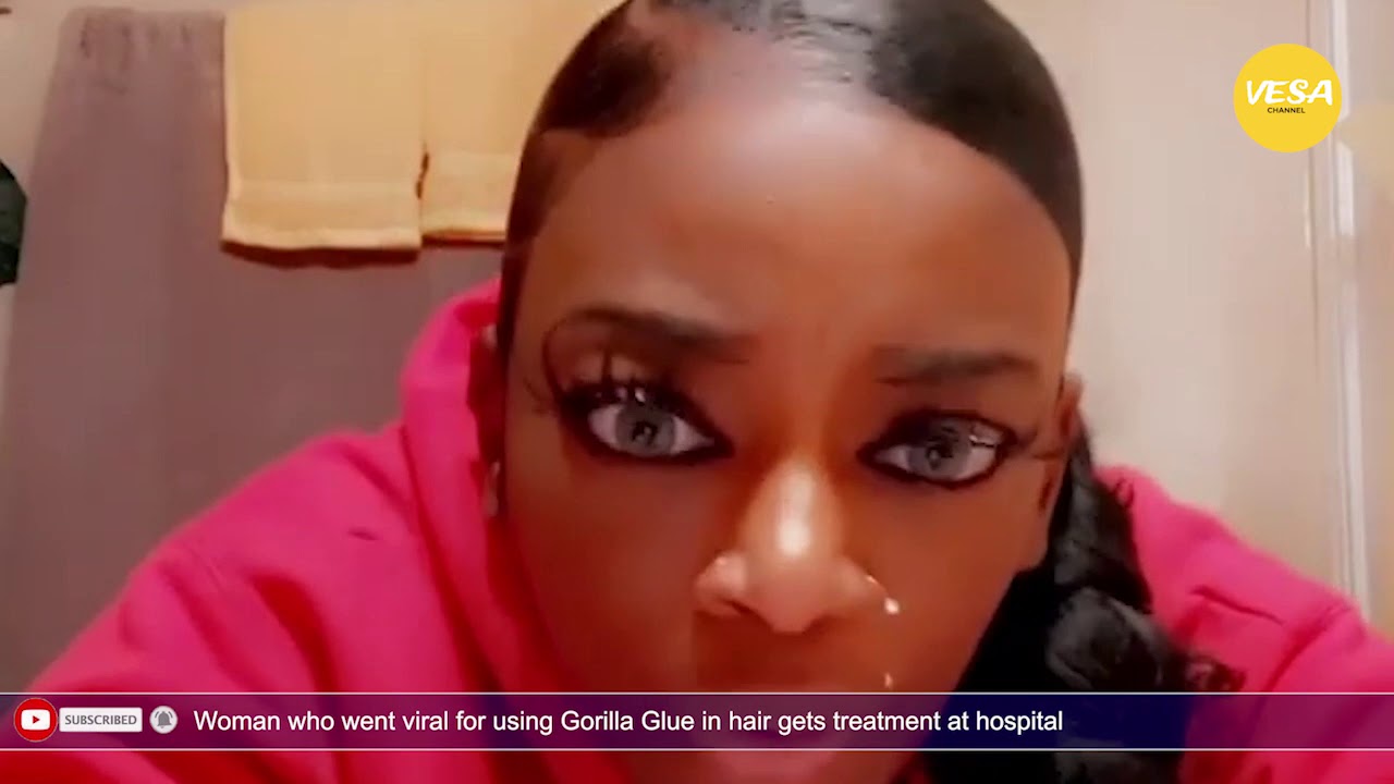 Woman seeks hospital treatment after using Gorilla Glue instead of ...