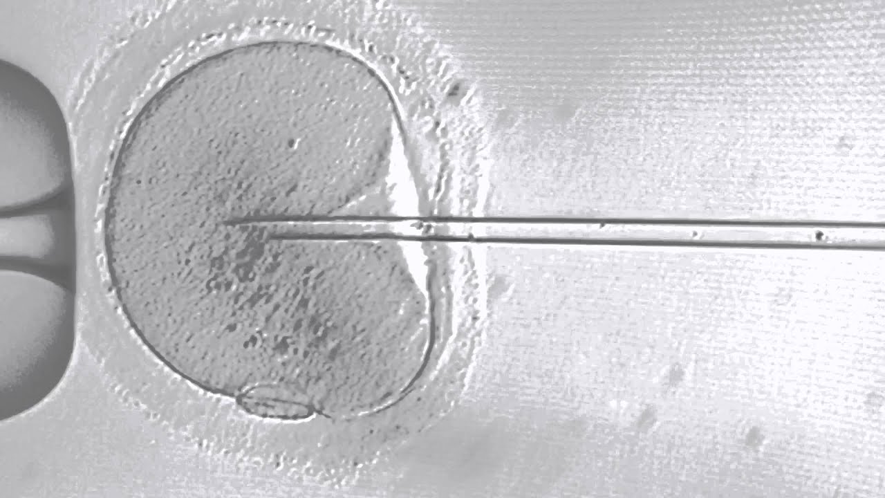 Intracytoplasmic Sperm Injection Dallas
