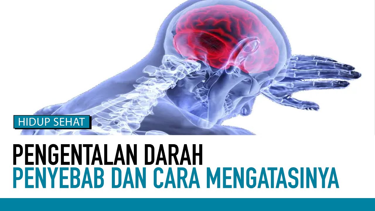 Kenali Penyebab dan Cara Mengatasi Gejala Awal Pengentalan Darah | Hidup Sehat tvOne