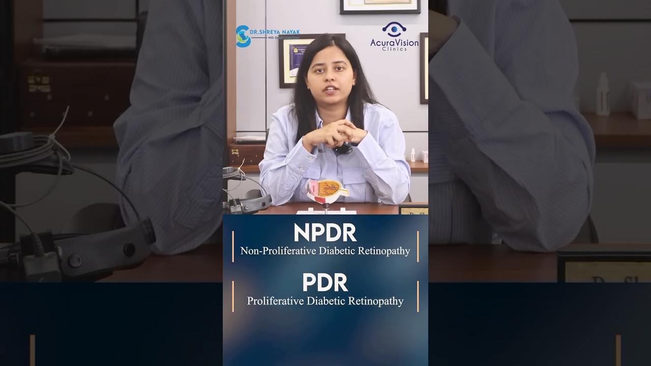 Diabetic Retinopathy has two stages—early (NPDR) and advanced (PDR). Both can cause vision loss.