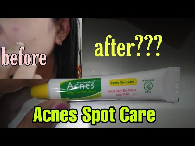 Review Obat Jerawat Acnes Spot Care Youtube