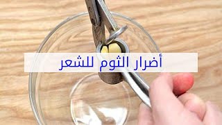 أضرار الثوم للشعر