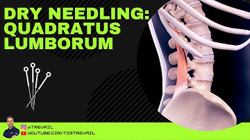 Dry Needling: Quadratus Lumborum