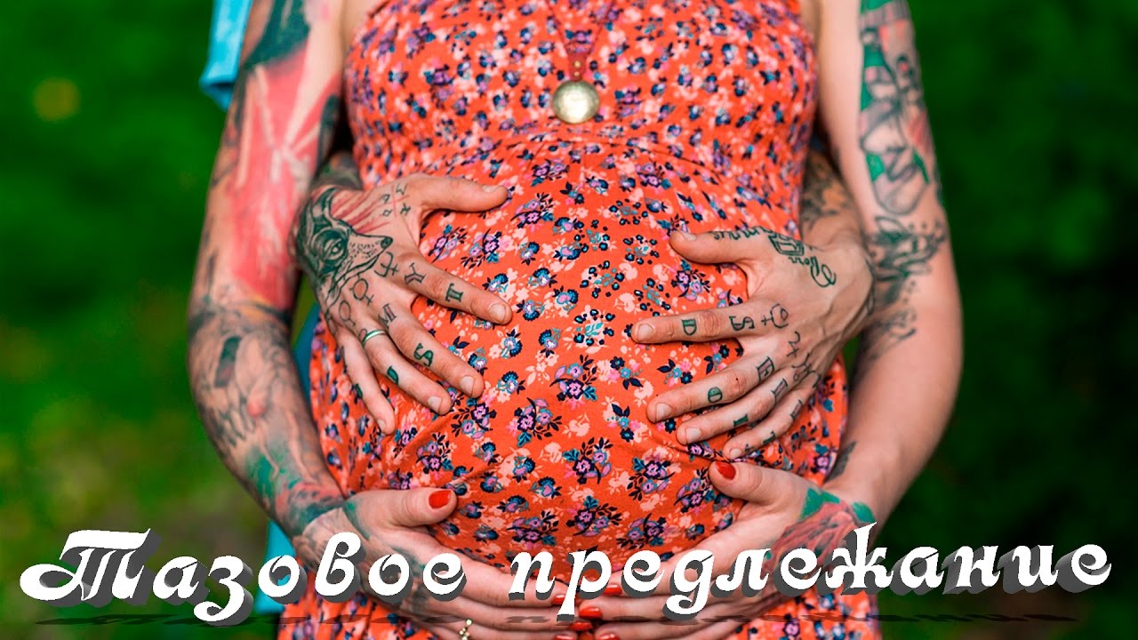 ВНИМАНИЕ!!! Тазовое предлежание. Беременность и роды. Беременность неделя. Как рожают. - YouTube
