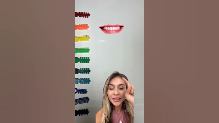 Best Braces Colors-For Making Teeth Look White