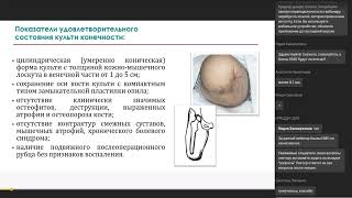 Лучевая диагностика пороков и болезней культей конечностей после операций .