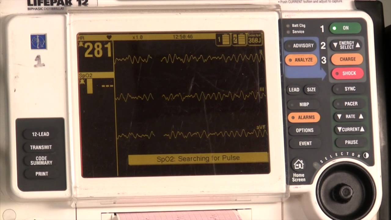 Defibrillator usage and paddle placement - YouTube