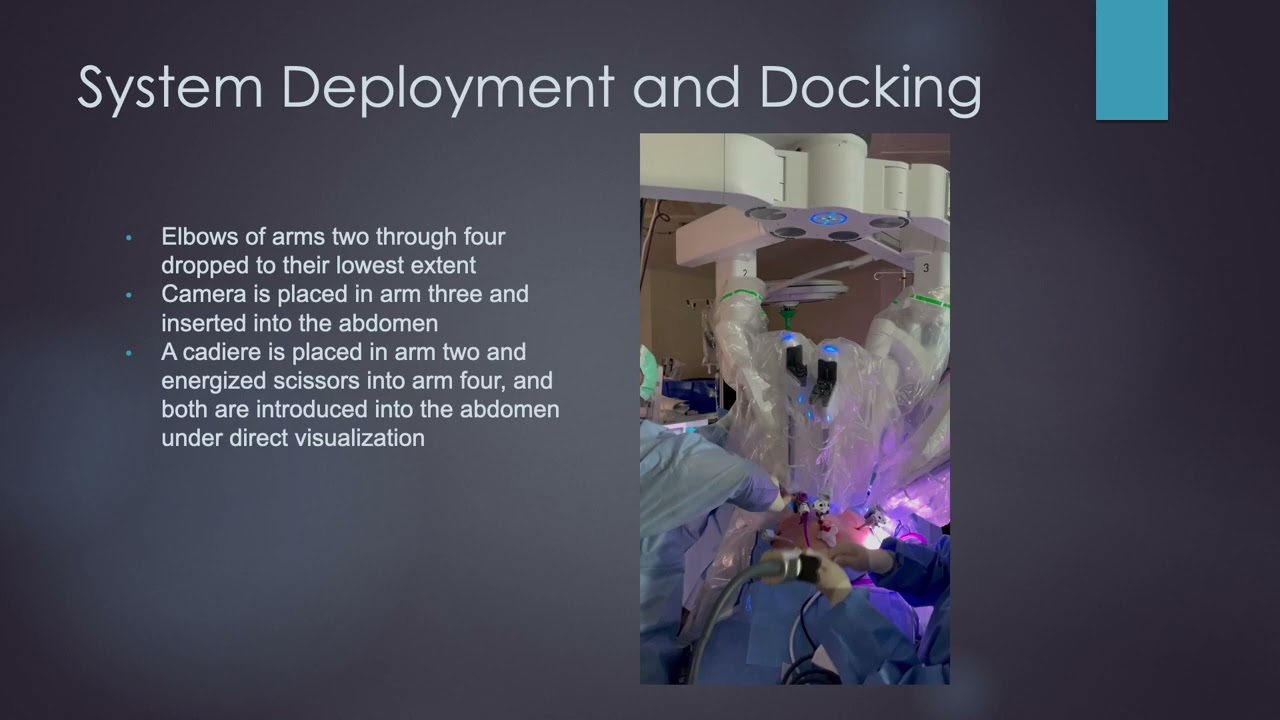 How to perform Intraoperative cholangiogram during robotic cholecystectomy