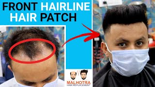 LeModish 100 Human hair Men Patch Thin Skin PU Lace Front Hair Extension  Price in India  Buy LeModish 100 Human hair Men Patch Thin Skin PU Lace Front  Hair Extension online