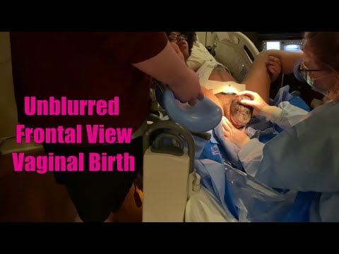 Vaginal Childbirth (Unblurred Frontal View)