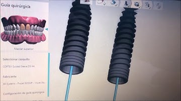 Fully Guided Case - by Dr. Orlando Alvarez