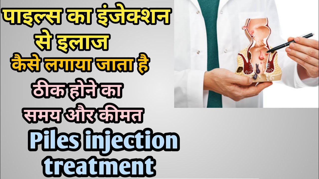 पाइल्स का इंजेक्शन से कैसे इलाज किया जाता है? Piles injection